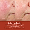 Double Serum
